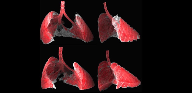 Un nanovehículo para liberar fármacos en células dañadas