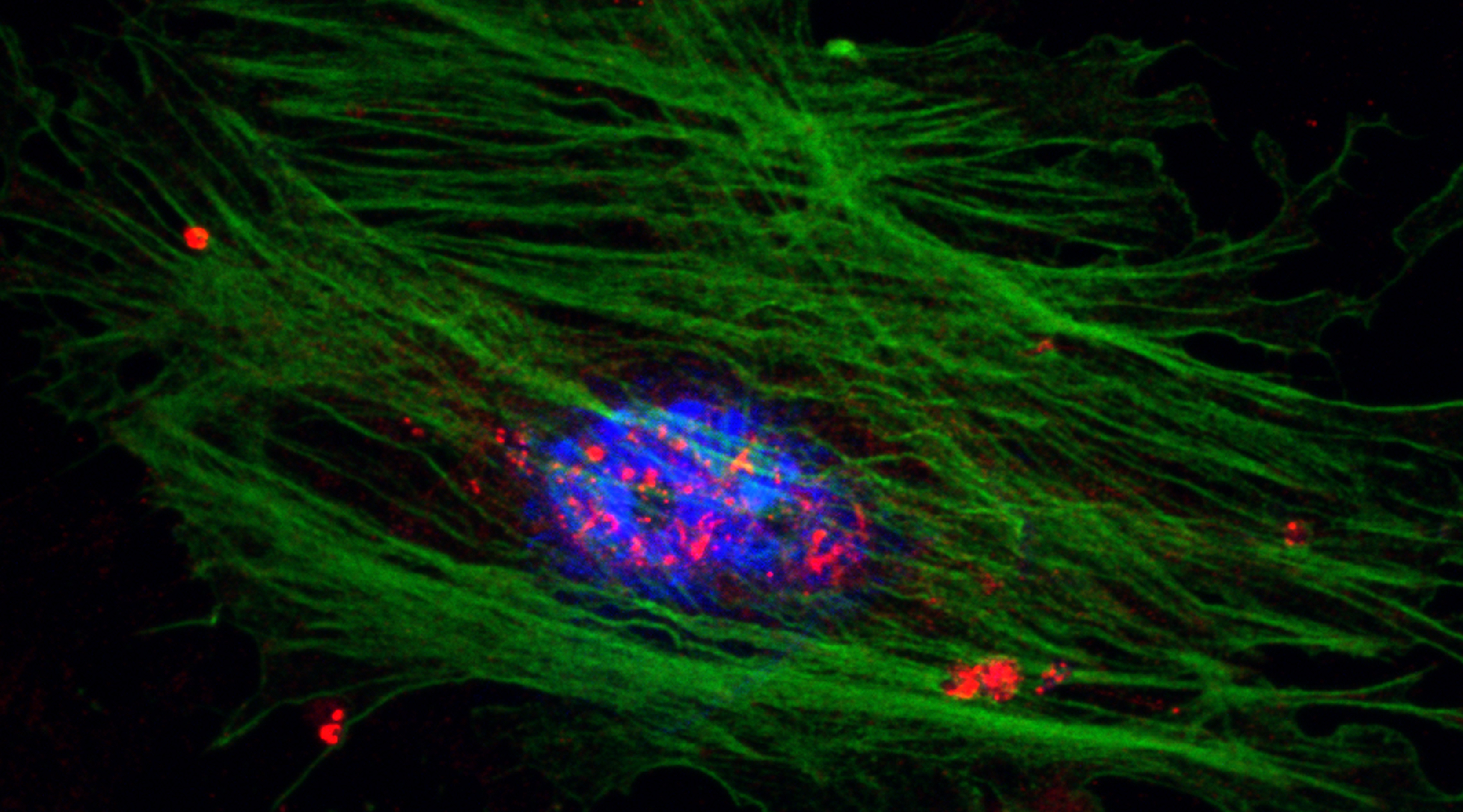 Descifran un nuevo mecanismo de progresión de la fibrosis en enfermedades hepáticas crónicas