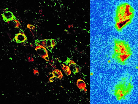 Diseño y ensayo pre-clínico de una nueva molécula para la enfermedad de Parkinson