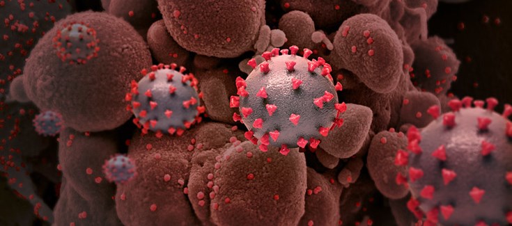 Los pacientes con COVID-19 críticos presentan una diseminación del genoma vírico en su sangre