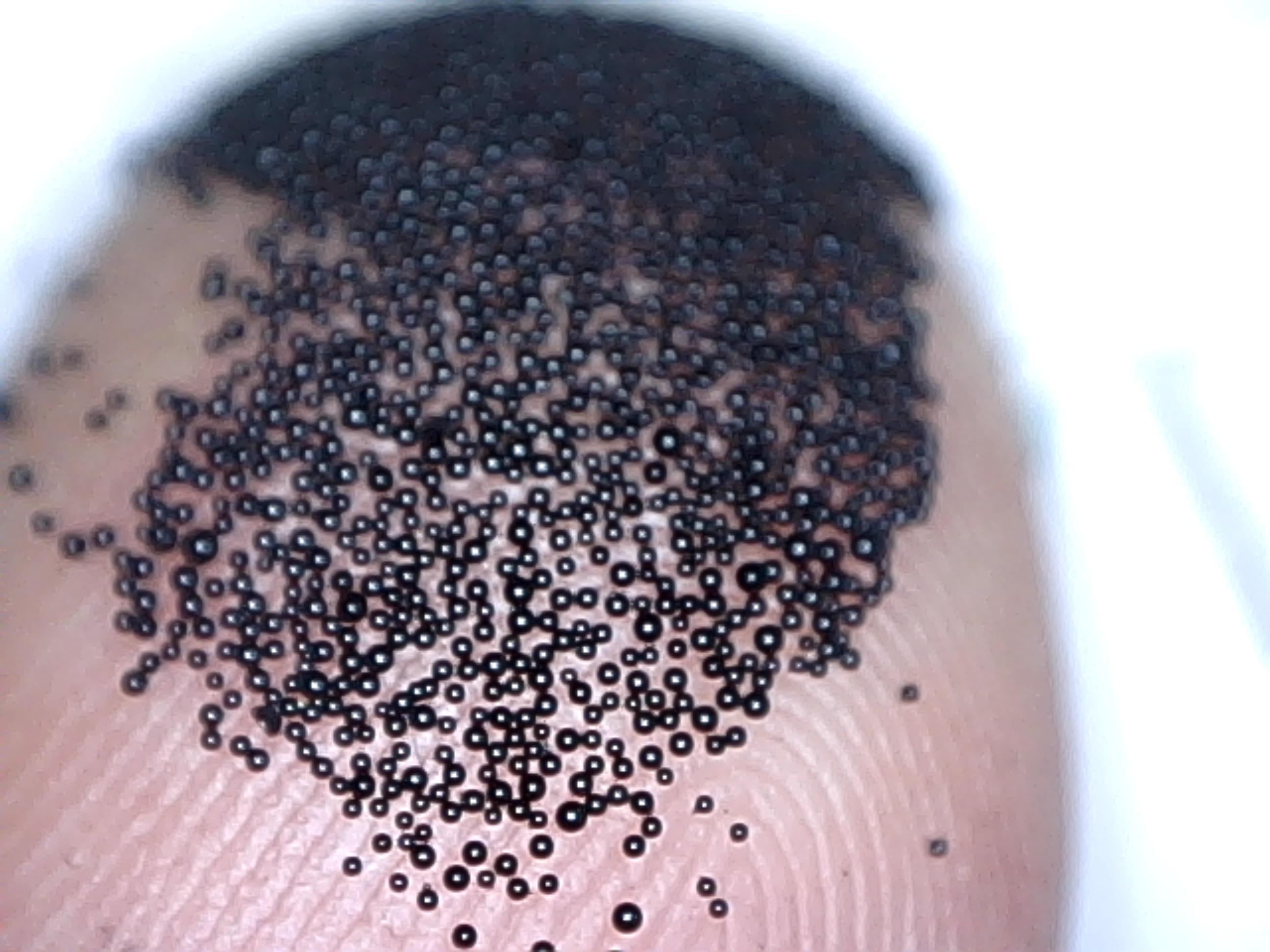 Un estudio demuestra la seguridad de las microesferas de carbono por vía oral para el tratamiento de la cirrosis