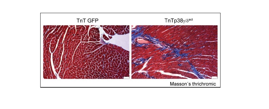Descubren dos proteínas esenciales para el metabolismo del corazón de los recién nacidos