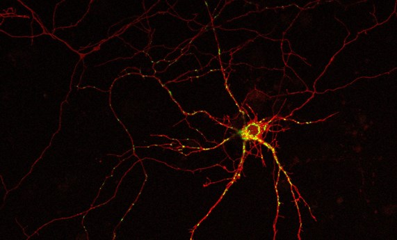 Descubierto un mecanismo molecular relacionado con la muerte de las neuronas