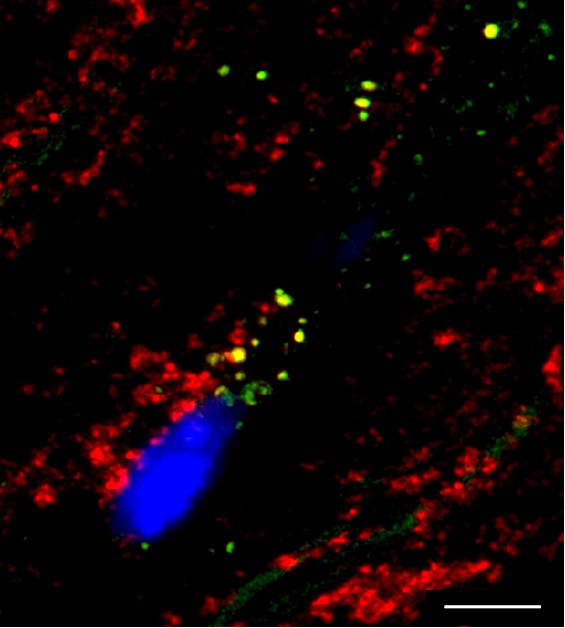 Una inmunoterapia experimental logra revertir el daño energético del corazón causado por el colesterol