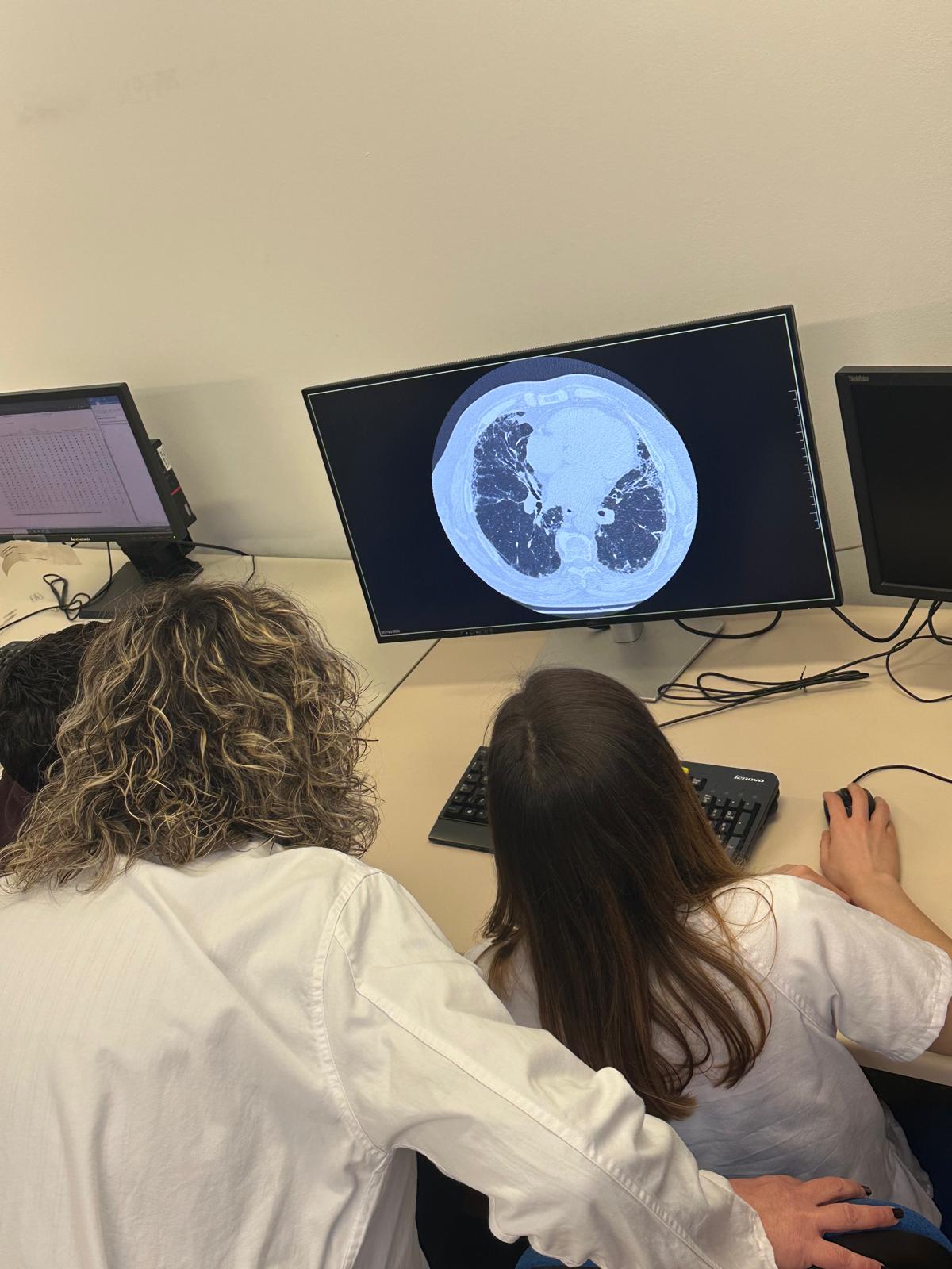 CIBER y Boehringer Ingelheim se unen para impulsar la investigación en enfermedades pulmonares intersticiales