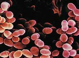 Demuestran que la bacteria de la neumonía también puede invadir el corazón