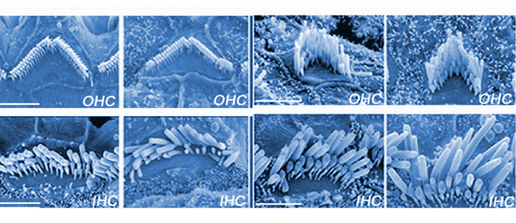 Demuestran la relación del gen 'Wbp2' con la hipoacusia