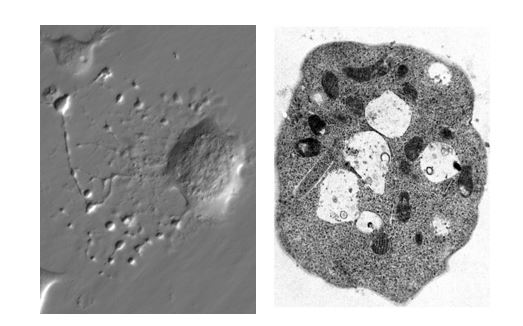 Investigadores del CIBER-BBN coordinan un estudio que ha convertido células de la piel en plaquetas